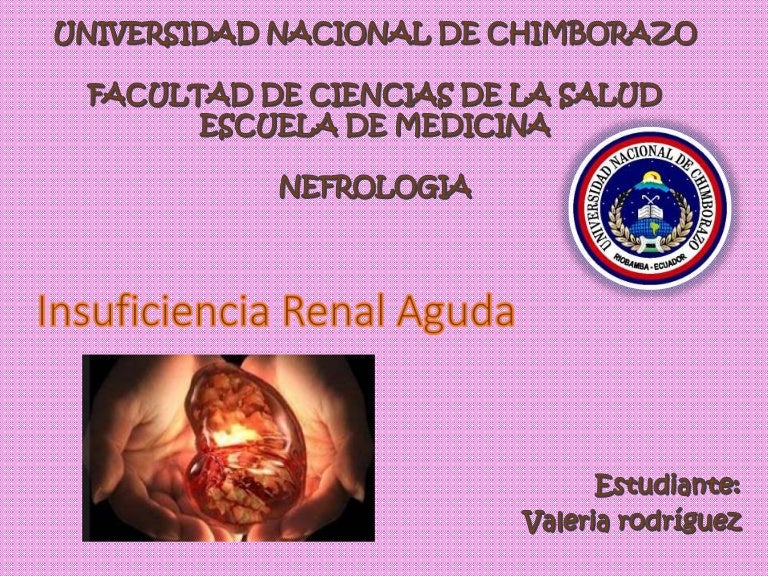 Insuficiencia renal aguda medicina interna